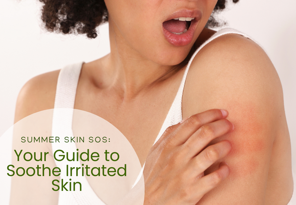 Summer Skin SOS: Your Guide to Soothe Irritated Skin